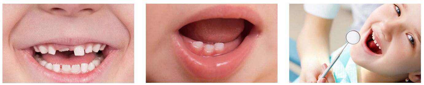 INNOWACYJNA SZCZOTECZKA MARKI LES BABYGATOS  